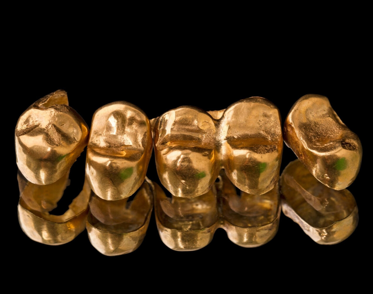 Скупка  стоматологического золота в Новосибирске